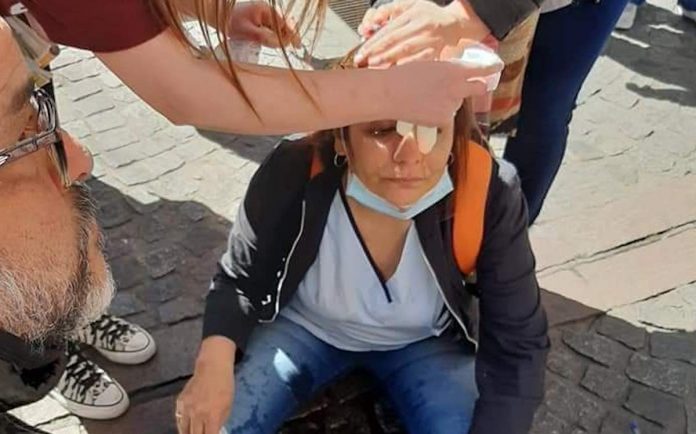 Policía de Larreta reprimió a enfermeras que manifestaban en la Ciudad